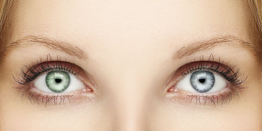 Different Colour Eyes: Heterochromia Explained