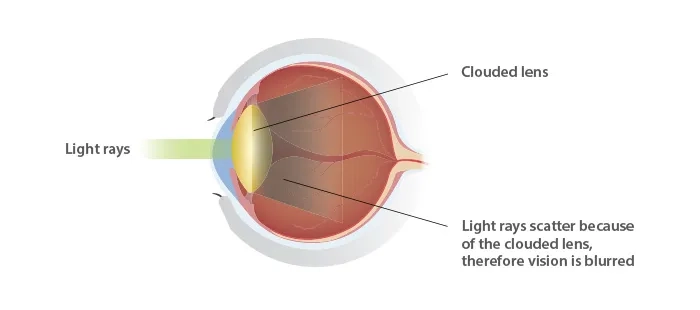 eye diagram