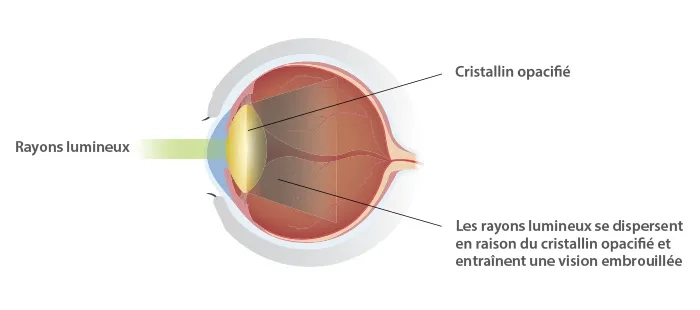 eye diagram french