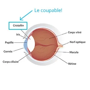 diagram de l'oeil